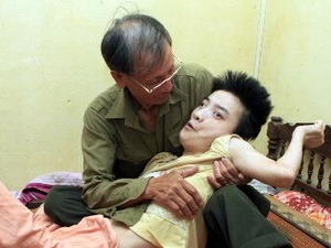 Loạt ảnh kinh hoàng về di chứng chất độc da cam Mỹ sử dụng trong chiến tranh Việt Nam với người dân